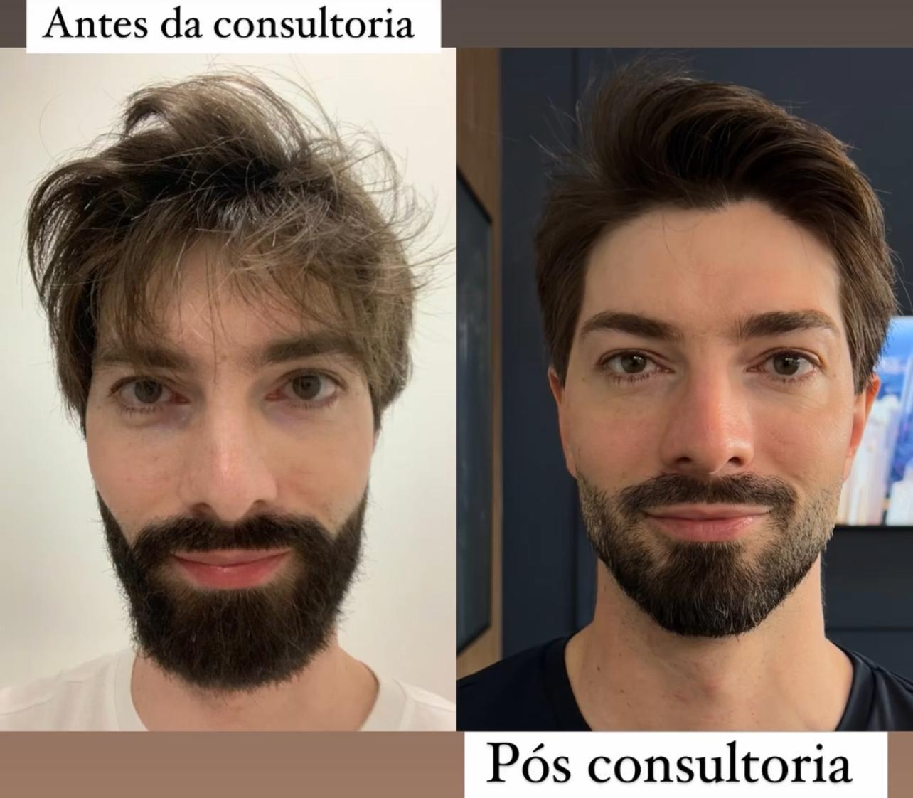 Antes e Depois - Cliente 1