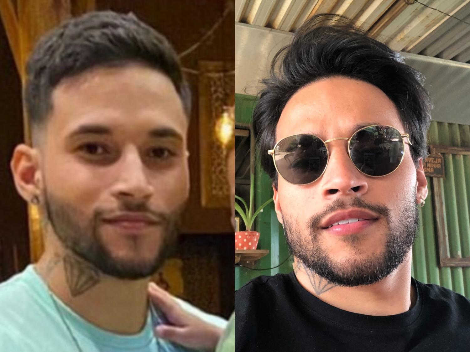 Antes e Depois - Cliente 12