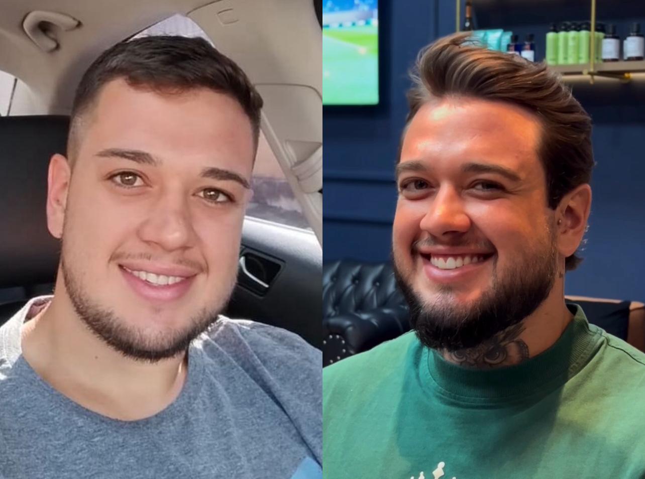 Antes e Depois - Cliente 3