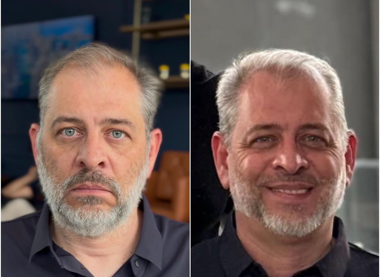 Antes e Depois - Cliente 4