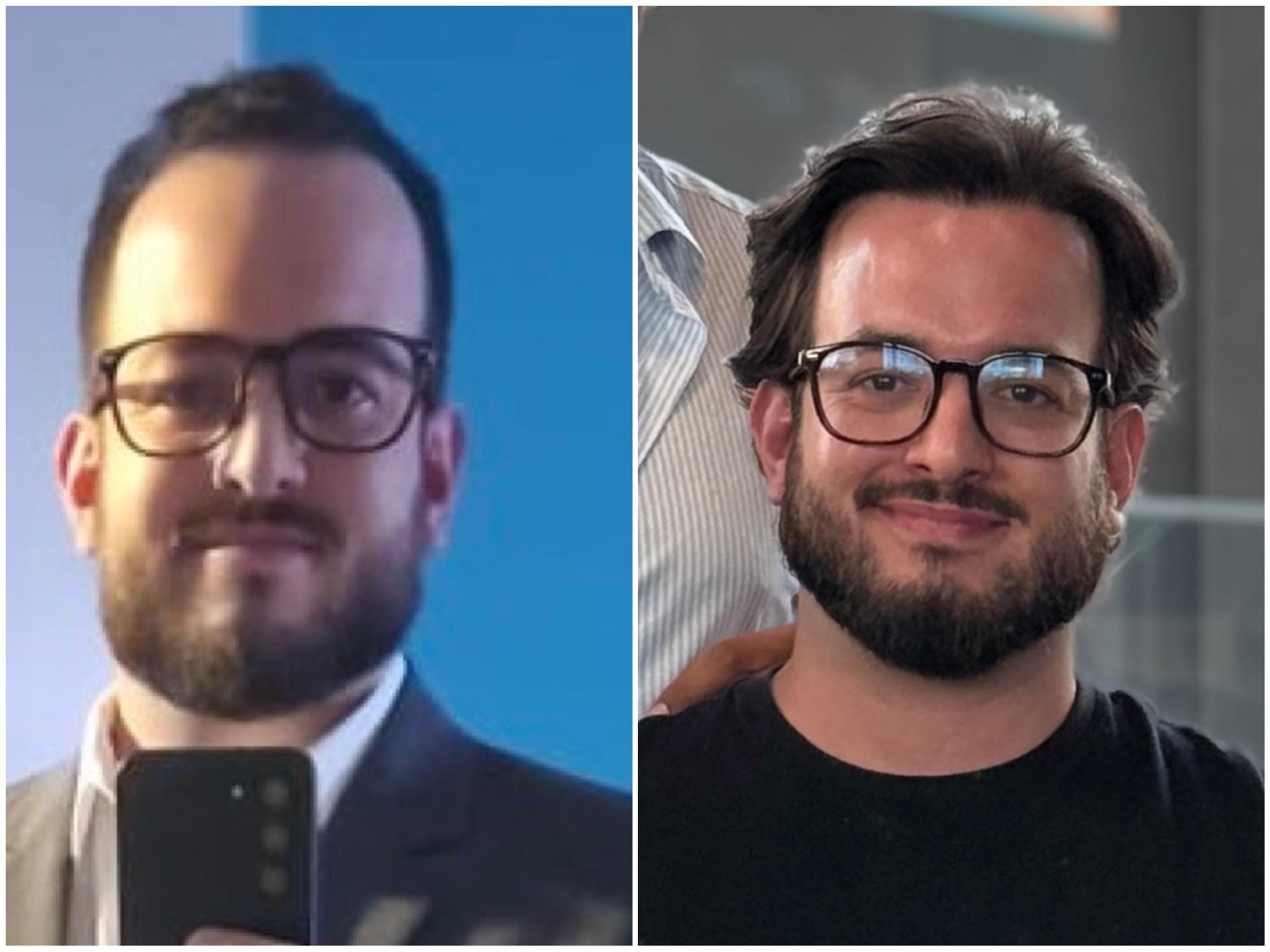 Antes e Depois - Cliente 5