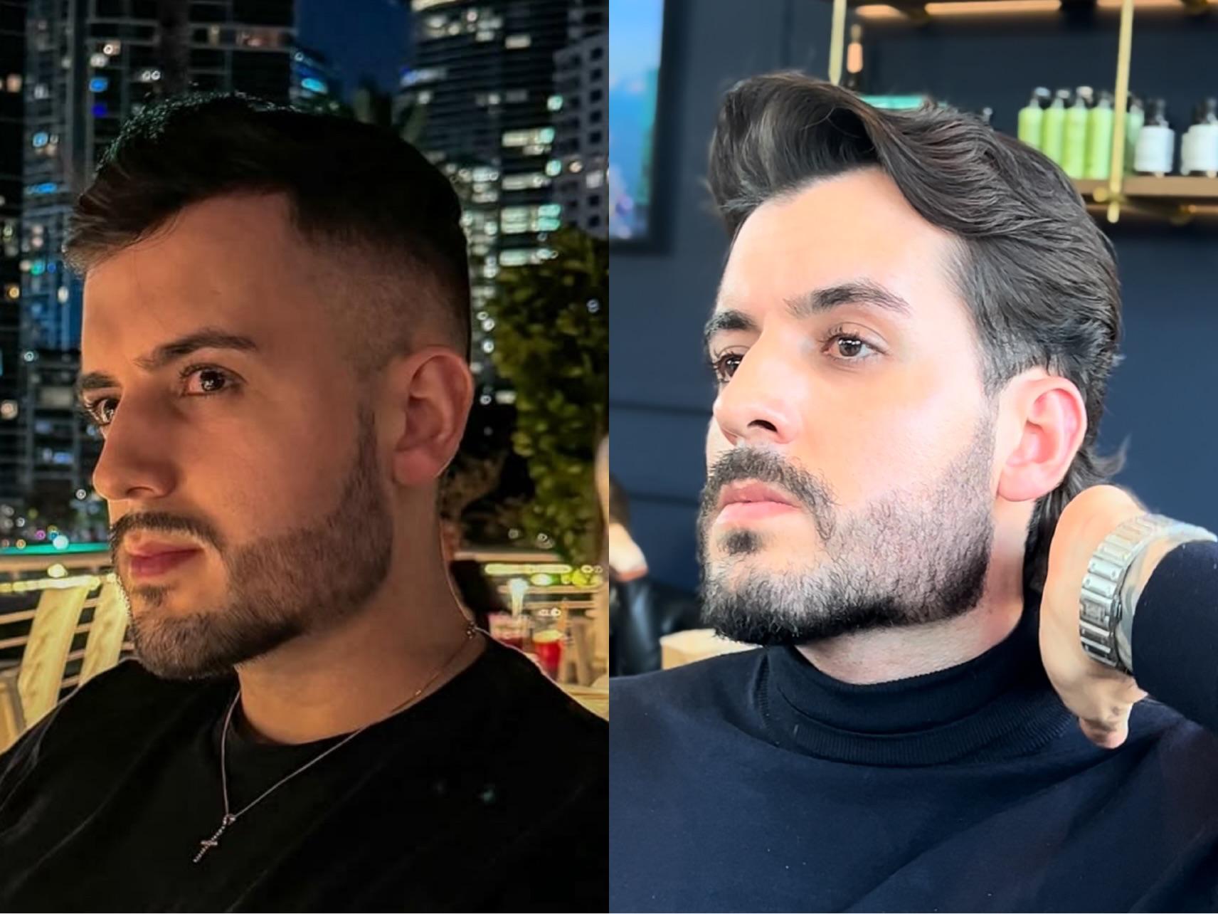 Antes e Depois - Cliente 7