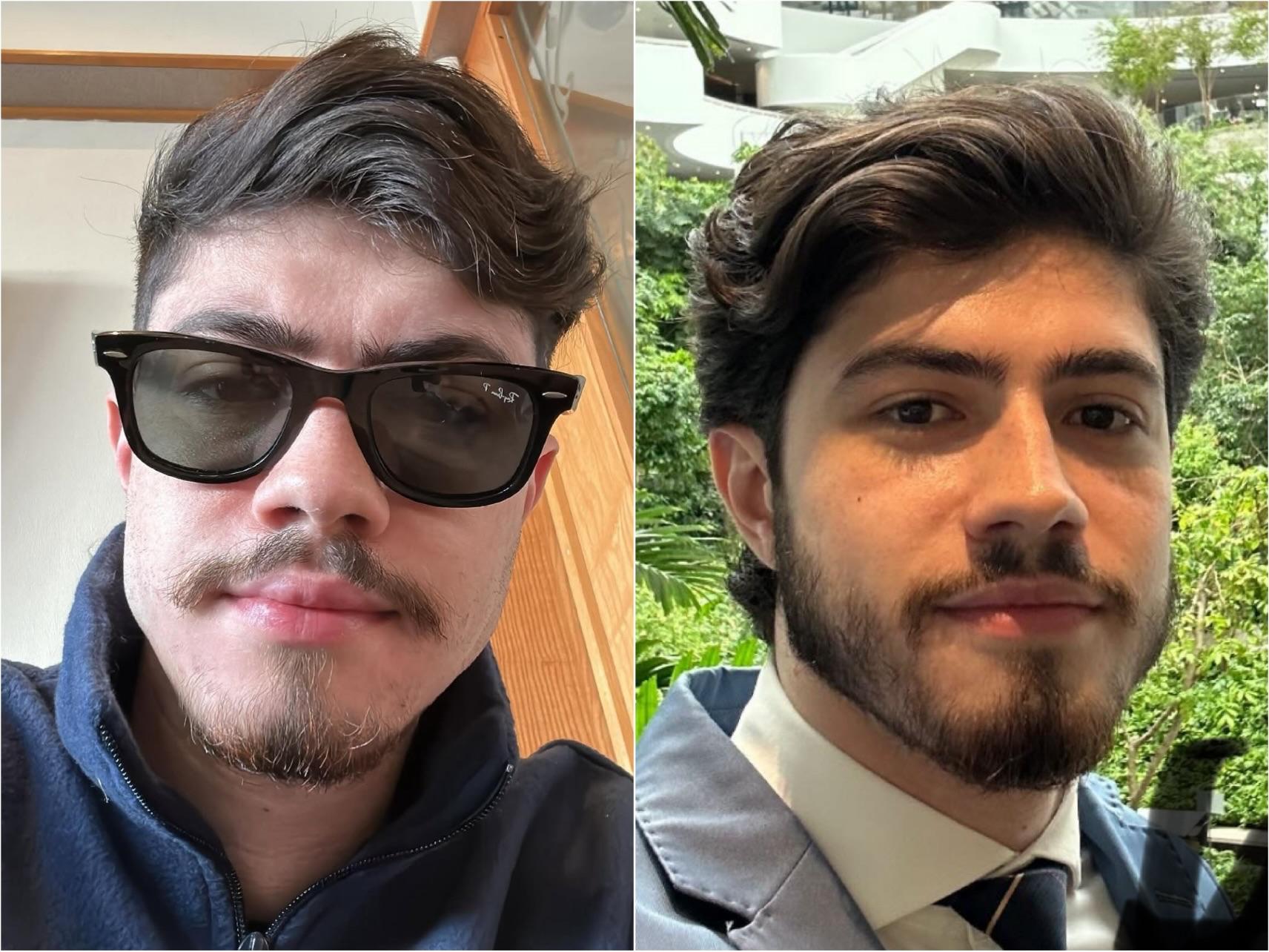 Antes e Depois - Cliente 8